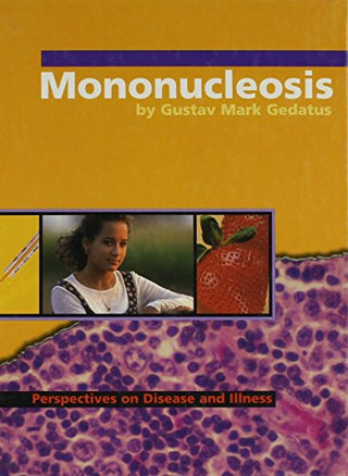 Mononucleosis