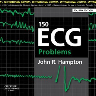 150 ECG Problems