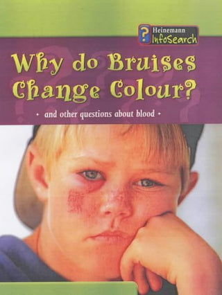 Why Do Bruises Change Colour? And Other Questions About Blood