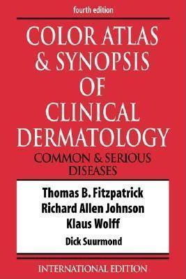 Color Atlas And Synopsis Of Clinical Dermatology - Common And Serious Diseases - Thryft