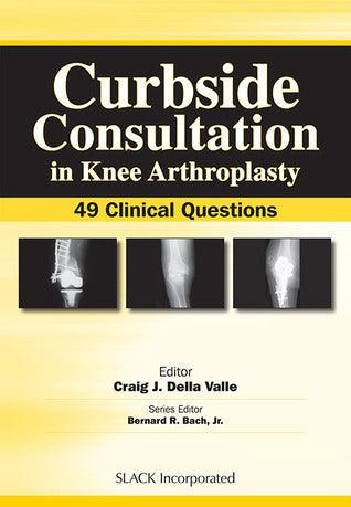 Curbside Consultation in Knee Arthroplasty : 49 Clinical Questions - Thryft