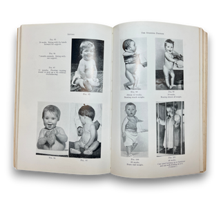 The Development of the Infant and Young Child: Normal and Abnormal
